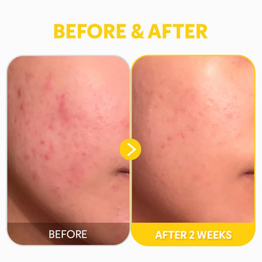 TIRTIR Vitamin C 24% Serum for Face | Dark Spot Corrector for Sensitive Skin | Anti Aging Collagen Serum | Even Tone & Wrinkle Care | Korean Skincare | 1.01 fl oz